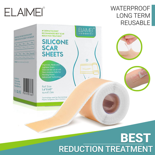 Elaimei Silicone Gel Sheet Patch Scar Removal Tape Skin Repair Medical Treatment Remover Wound Keloid Surgery, 1.5M