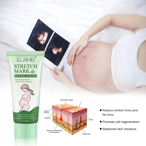Skin Care Anti Pregnancy Scar Cream Restore Stretch Mark Removal Post Pregnancy