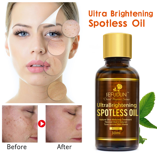 Skin Face Pure Oil Whitening Lightening Serum Dark Spot Bleaching Remover Spotless
